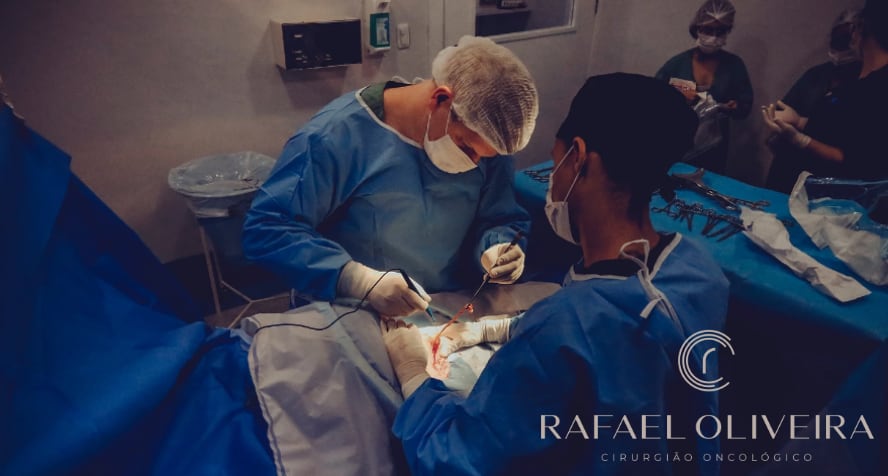 Você sabe o que é a Cirurgia Oncológica?